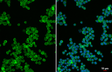 Anti-S100A9 antibody [HL6069] used in Immunocytochemistry/ Immunofluorescence (ICC/IF). GTX648148